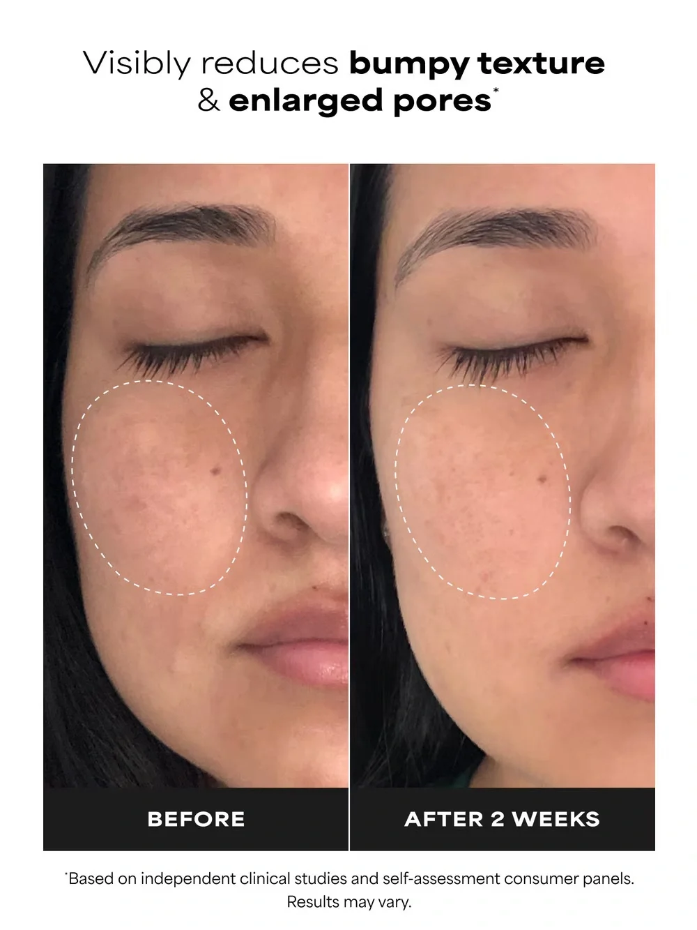 Paulas Choice clinical niacinamide